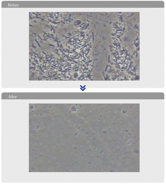 口腔内細菌検査 治療前後2