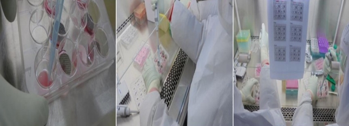 細胞変性効果(CPE)cont