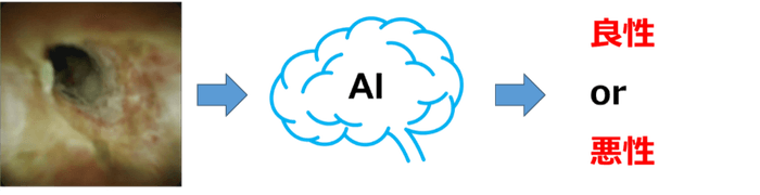 図2：AIによる胆道鏡画像の良悪性診断支援のイメージ