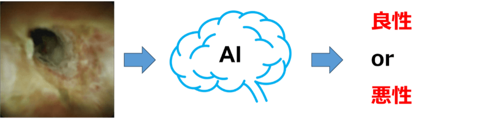 図2:AIによる胆道鏡画像の良悪性診断支援のイメージ