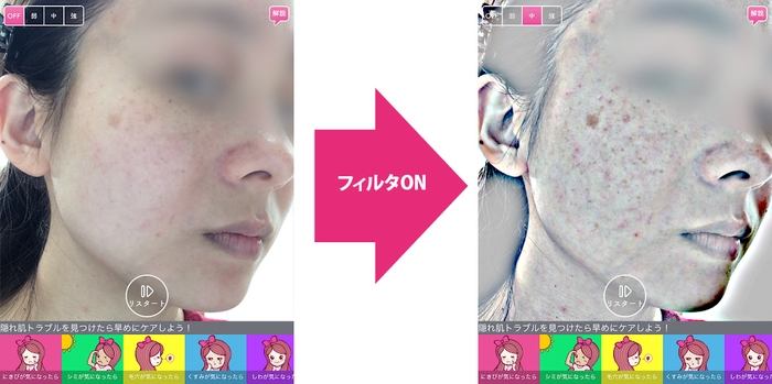 フィルタON 隠れ肌トラブルが浮き彫り(単体画像)