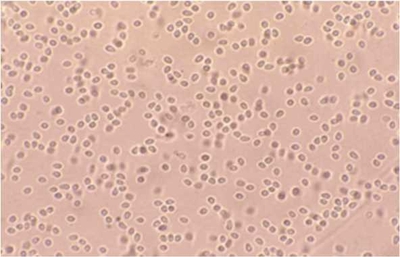 図1　べこ病原因虫（Microsporidium seriolae）の胞子。大きさは、長さ3μm、幅2μm程度。