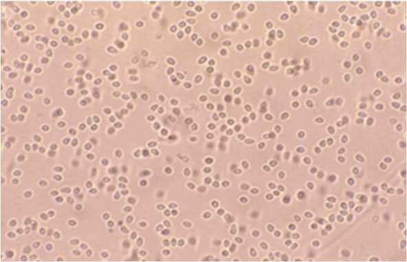 図1　べこ病原因虫（Microsporidium seriolae）の胞子。大きさは、長さ3μm、幅2μm程度。