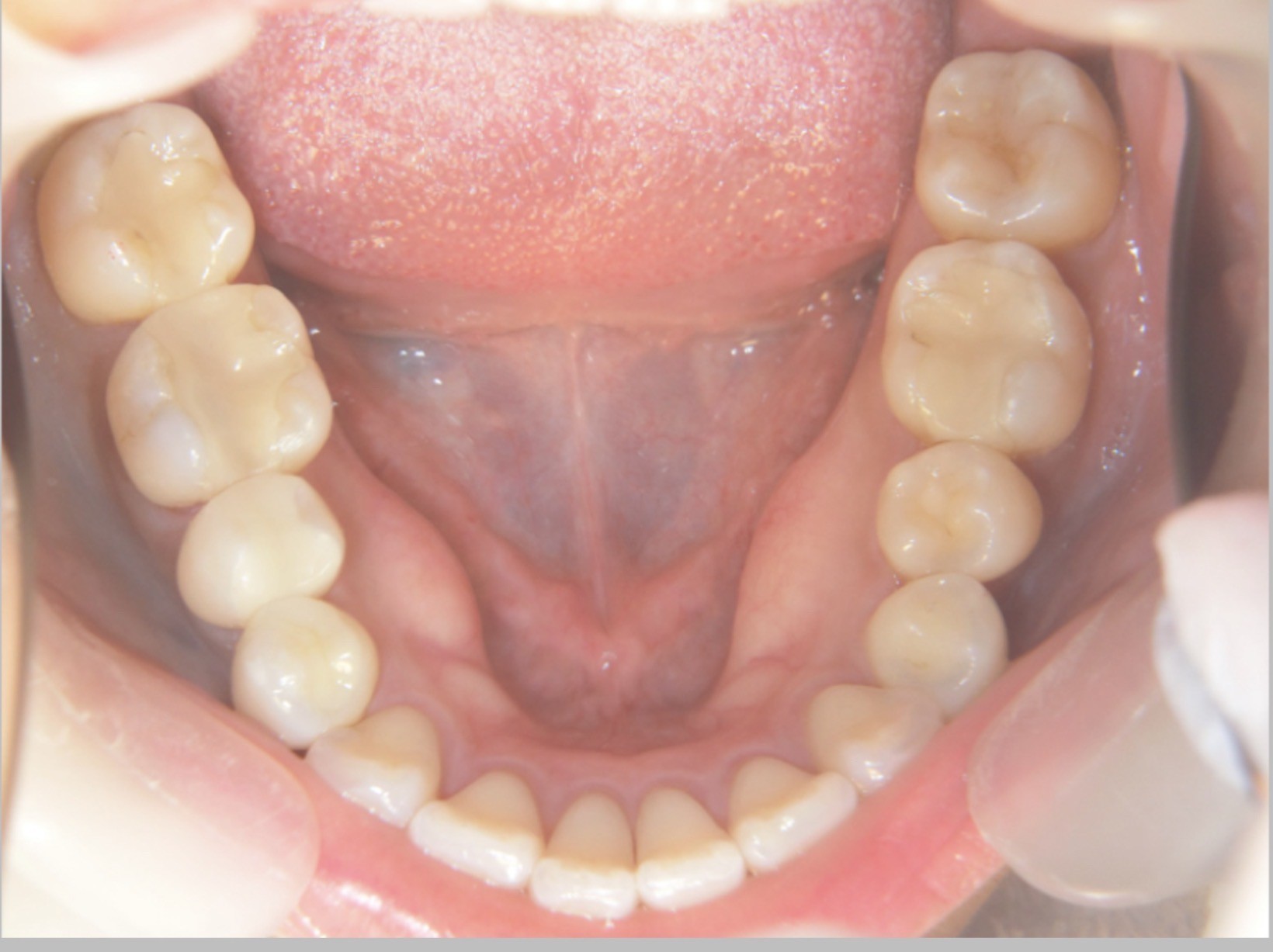 “寝ているのに疲れる”と感じる人へ　朝の顎の重さや口の違和感、その背景にあるものとは

