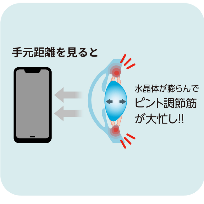 疲れ目の主な原因は「目のピント調節力」