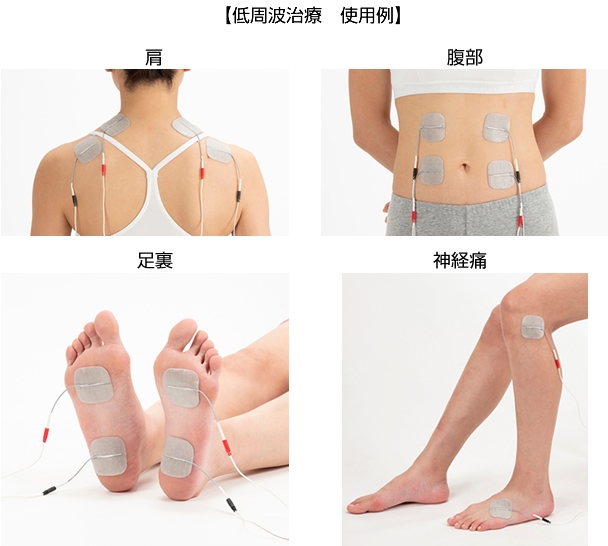 低周波治療 使用例