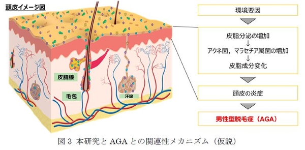 図3 本研究とAGAとの関連性メカニズム（仮説）