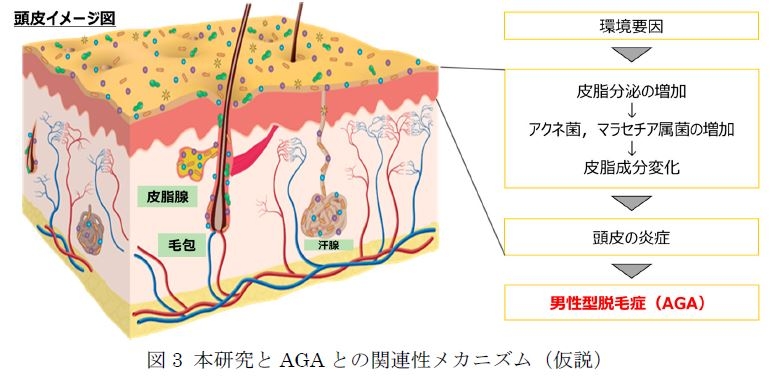 図3 本研究とAGAとの関連性メカニズム（仮説）