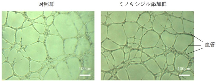 図２．ミノキシジル添加による血管網形成の促進