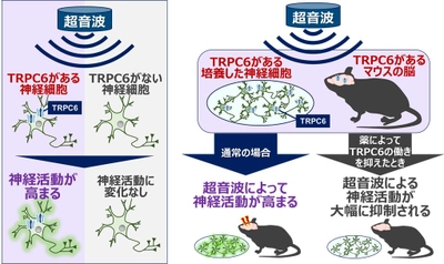 超音波刺激で脳活動を高めるのに不可欠な脳内センサーを同定　～認知症やうつ病など精神・神経疾患の新たな治療法への応用に期待～