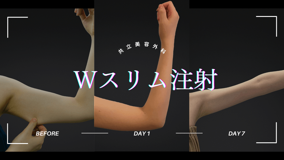 Wスリム注射症例写真