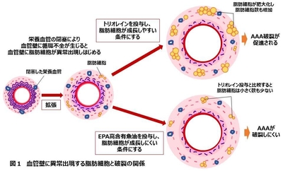図1 血管壁に異常出現する脂肪細胞と破裂の関係