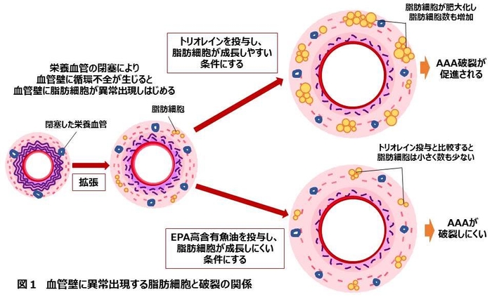 図１　血管壁に異常出現する脂肪細胞と破裂の関係