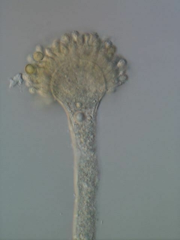 アスペルギルス・フラブス  