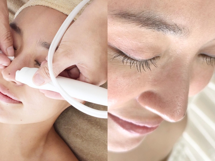 次世代 毛穴洗浄