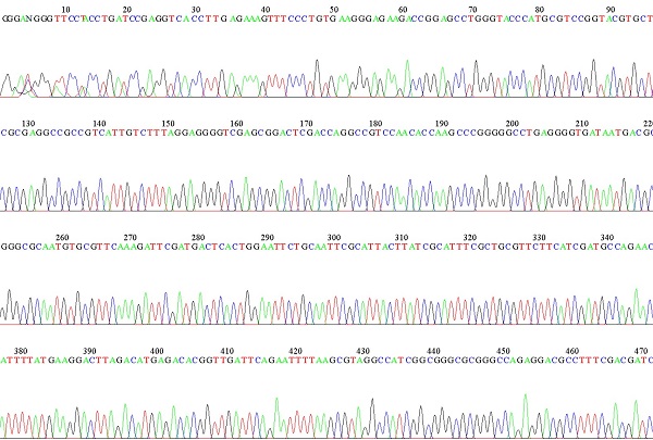 [奈文研コラム] 文化財とPCR