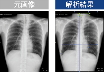 自動CTR推定機能イメージ