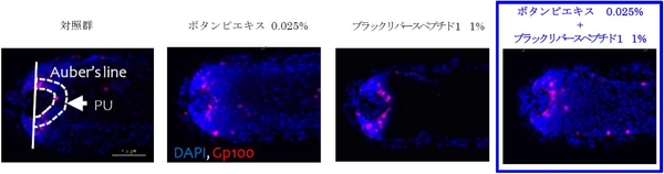 Auber's line：毛球部の最も太い部分を横断する線　　 PU：Gp100量測定エリア　　＊赤く染色されている部分がGp100