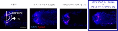 Auber's line:毛球部の最も太い部分を横断する線 PU:Gp100量測定エリア *赤く染色されている部分がGp100