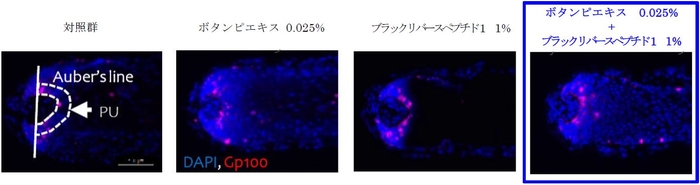 Auber's line：毛球部の最も太い部分を横断する線　　 PU：Gp100量測定エリア　　＊赤く染色されている部分がGp100