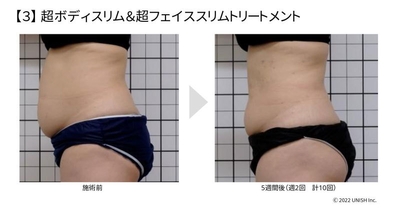 【3】超ボディスリム&超フェイススリムトリートメント