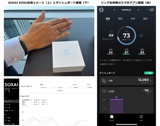 竹田健康財団とNTTドコモビジネス、スマートリングを活用した 術後患者の経過観察に関する実証実験を開始 