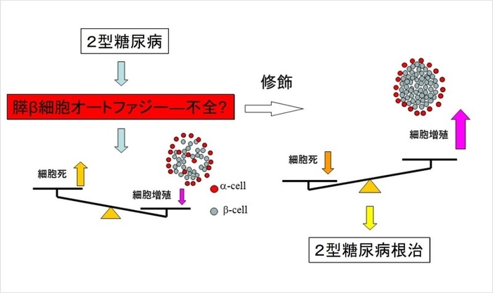 膵β細胞のオートファジー不全と2型糖尿病