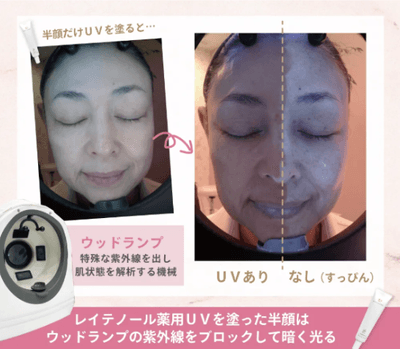 紫外線カット効果の検証