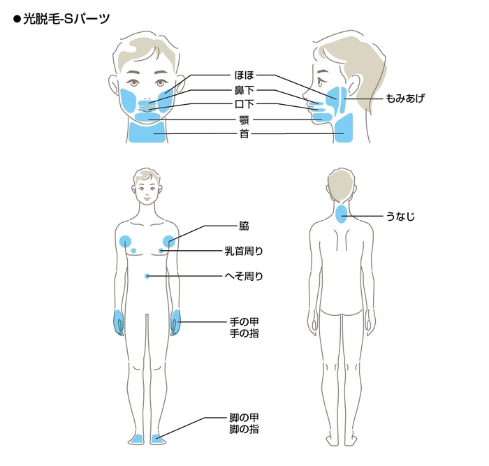 光脱毛Sパーツ