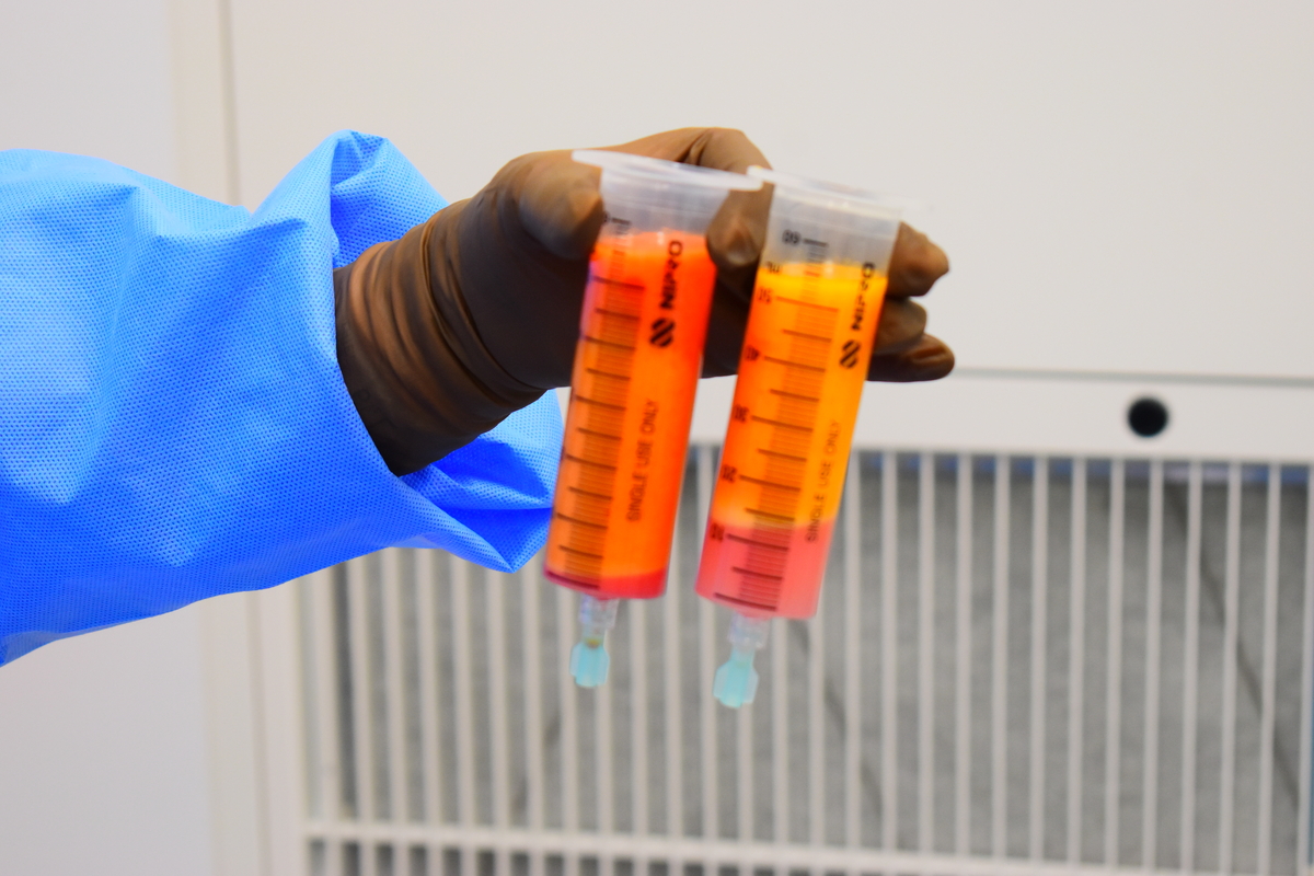 変形性膝関節症に再生医療という新たな選択肢 : こうのす共生病院が専門外来を設置、地域医療の現場で広がる新治療