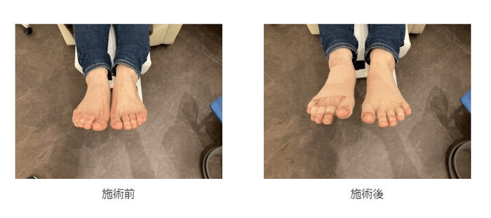 施術前/施術後