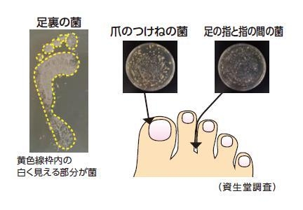 足特有のニオイ・ムレ発生のメカニズム