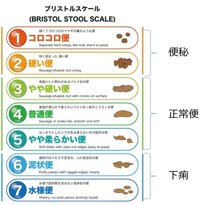 ブリストルスケール