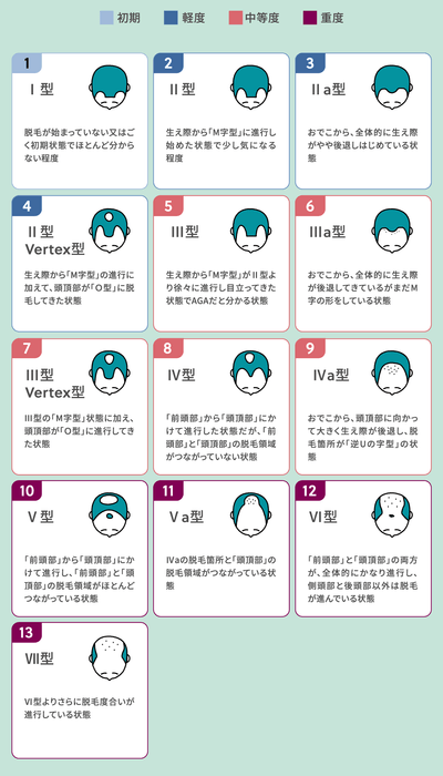 薄毛(AGA)の状況レベル