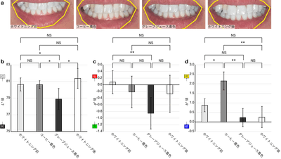 図1. アプリで撮影したホワイトニング前後の歯の画像(a)と色の変化(b-d)