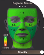 部分的肌スコア