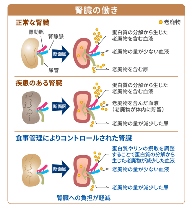 食事管理と腎臓