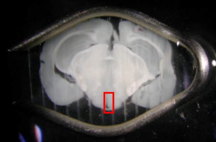 図１：手術で摘出したマウス脳を0.15mmの厚さに切り、顕微鏡で観察するために白金枠に張ったナイロン糸で固定