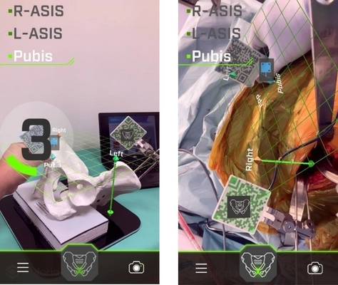 浅草病院、AR(拡張現実)技術を用いた人工股関節手術を開始