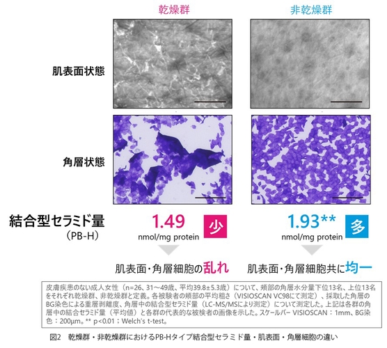 図2　乾燥群・非乾燥群におけるPB-Hタイプ結合型セラミド量・肌表面・角層細胞の違い