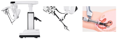 大阪初！関西メディカル病院、 最新鋭ロボットを用いたvNOTES子宮全摘術開始