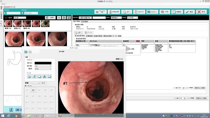 内視鏡に特化したレポートシステム