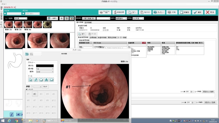 内視鏡に特化したレポートシステム