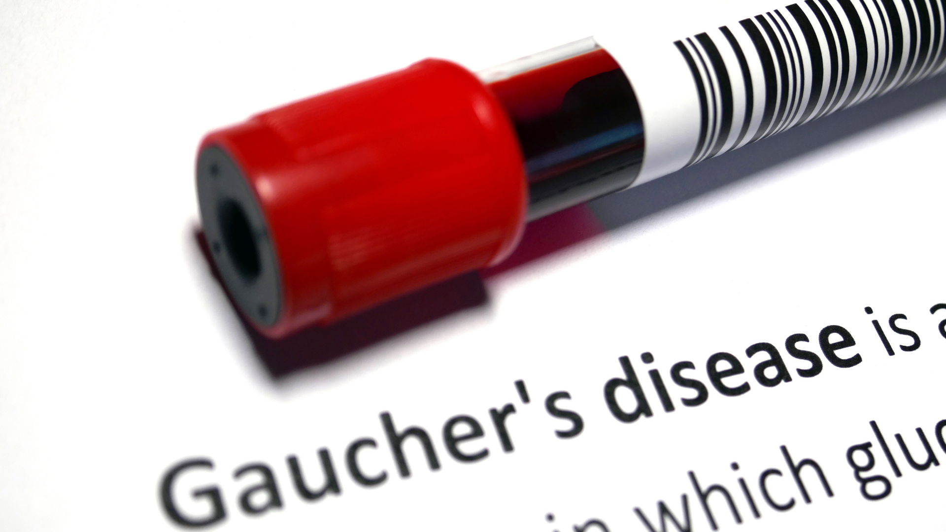 ゴーシェ病治療薬市場は、2025年までに21億1000万米ドルに達すると予測される