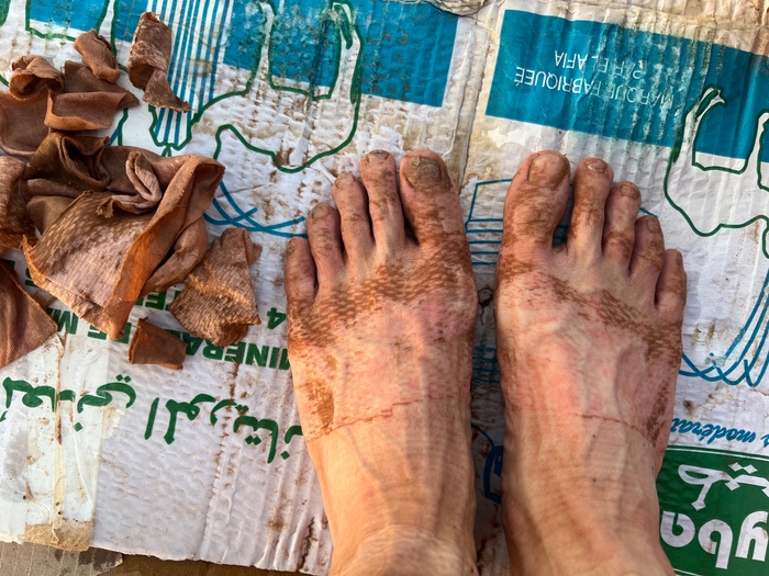 酷く疲弊する足(北田雄夫)