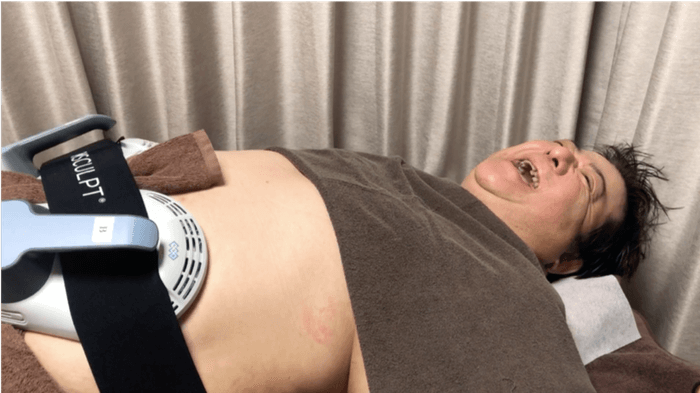 MED EMS by DIO LABO 腹筋マシン 美大生が彫刻刀で腹筋割ってくれてるみたいや～！」 医療でシックス