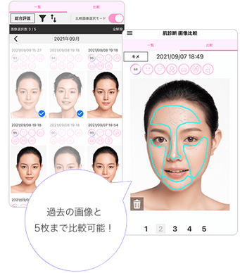 画像比較機能イメージ