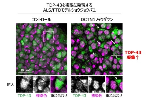 図3）DCTN1をノックダウンしたALS/FTDモデルショウジョウバエでは、本来は核に局在するはずのTDP-43が、細胞質で凝集・異常蓄積しているのが確認された。（緑はTDP-43、マゼンタは細胞の核を表す）（右写真の矢印がTDP-43の細胞質凝集）