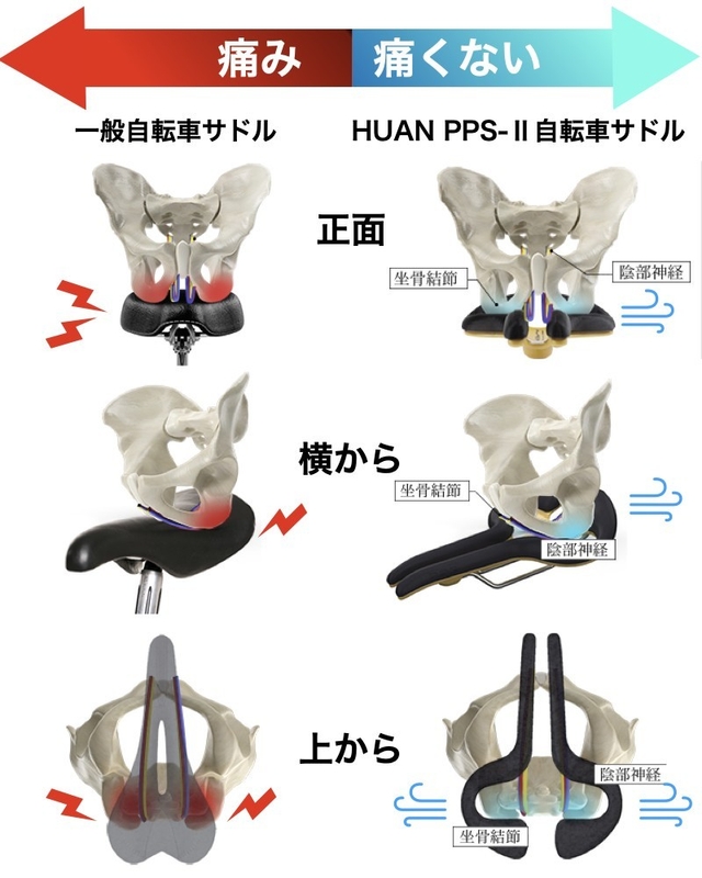 圧迫痛の原因