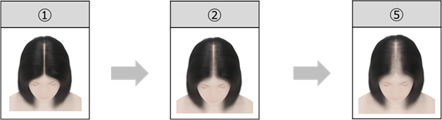 例 頭皮ケアの透け感